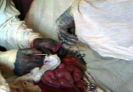 Operar en esas condiciones es un milagro